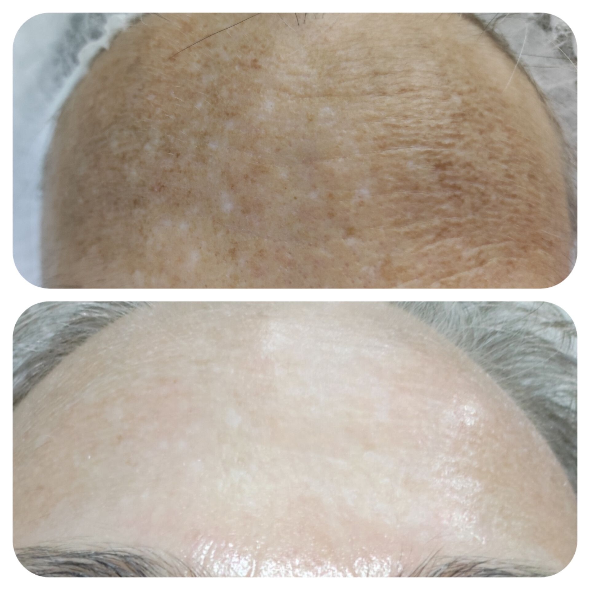 Antes y después del tratamiento
