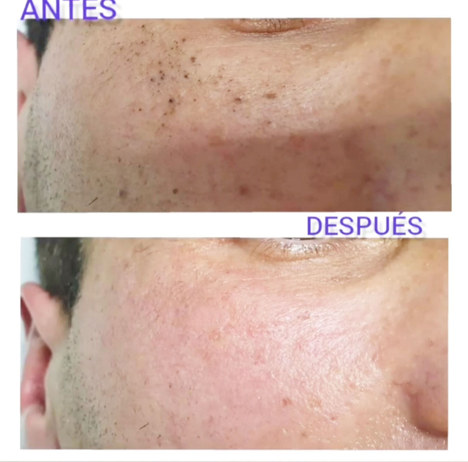 Antes y después del tratamiento